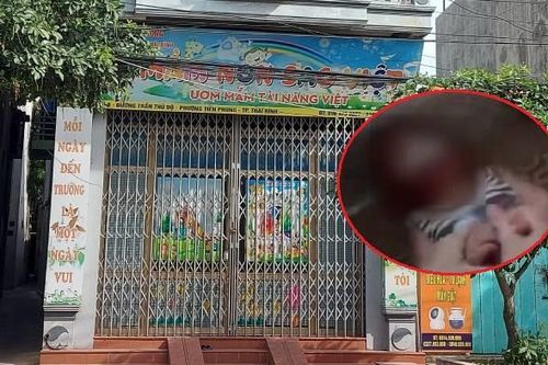 Khởi tố vụ án em bé 11 tháng tuổi bị nhét giẻ vào miệng