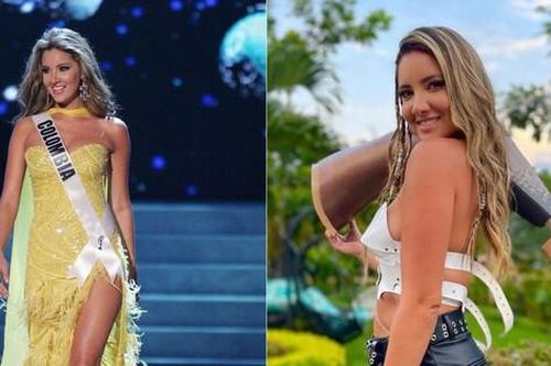 Nghị lực phi thường của Hoa hậu Hoàn vũ Colombia từng phải cắt bỏ chân trái