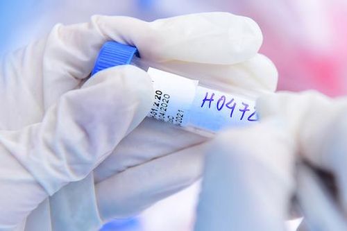 TP Hồ Chí Minh: Phát hiện 18 mẫu gộp dương tính SARS-CoV-2 của thí sinh thi tốt nghiệp THPT