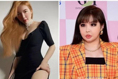 Elly Trần lộ mặt đơ cứng, nhiều người so sánh giống Park Bom phẫu thuật lỗi
