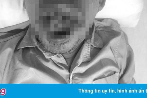 Trì hoãn điều trị vì dịch, người đàn ông bị biến dạng khuôn mặt