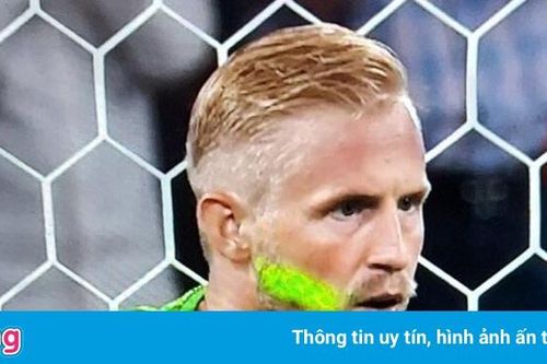 UEFA sẽ xử lý vụ Schmeichel bị chiếu laser