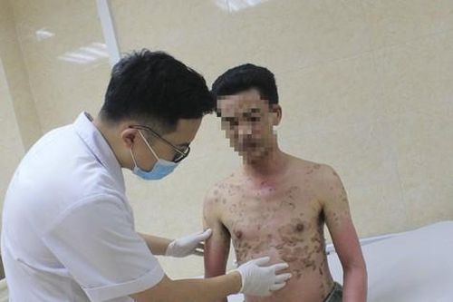 Người đàn ông Hà Nội cả người chuyển màu nâu, đau đớn như kim châm vì căn bệnh 'lạ'