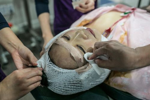 Mở rộng tai, làm teo cơ chân, phụ nữ Trung Quốc bất chấp để đẹp lên
