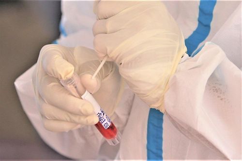 Quảng Ngãi thêm 4 người dương tính SARS-CoV-2