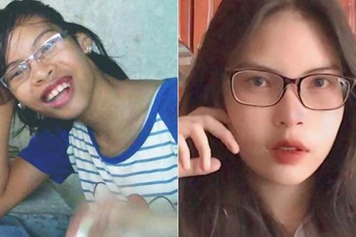 Bị chê 'miệng nạo được cả quả dừa', cô gái thay đổi 360 độ