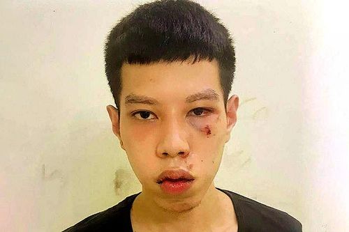 Anh em sinh đôi liên quan vụ cướp ven hồ Tây
