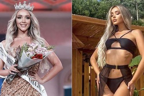 Mỹ nhân sở hữu thân hình vệ nữ đăng quang Hoa hậu Trái đất Albania