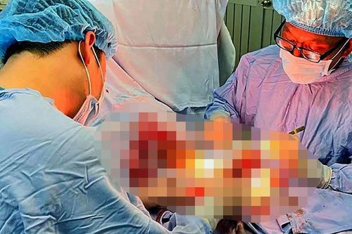 Nối thành công bàn tay bị cưa máy cắt rời