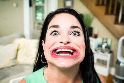Cô gái lập kỷ lục miệng rộng nhất thế giới