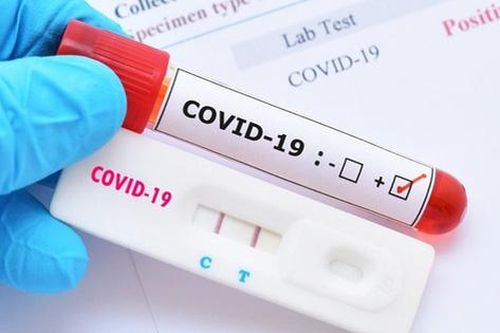 Cần biết: 16 loại test nhanh kháng nguyên SARS-CoV-2 được Bộ Y tế cấp phép