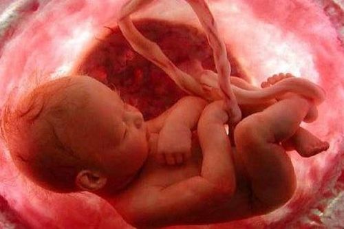 Đa ối - một bất thường sản khoa có thể gây nguy hiểm