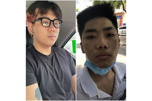 Bắt các đối tượng cướp xe máy nữ công nhân môi trường