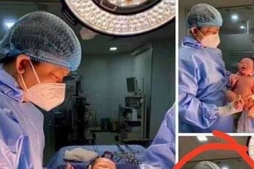 Xác minh thông tin bác sĩ nhường máy thở của ba mẹ để cứu sản phụ song sinh