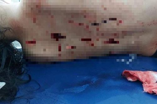 Đã bắt được nam sinh đâm bạn gái và mẹ bạn gái