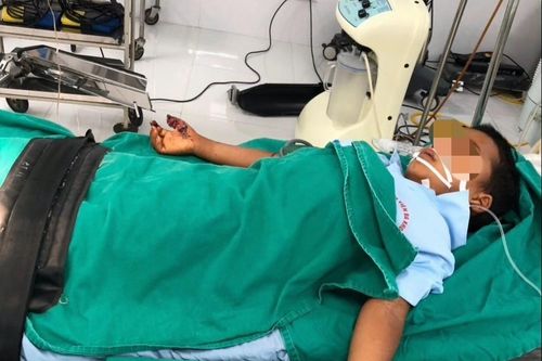 Nghịch kíp mìn, bé trai bị dập nát hai bàn tay