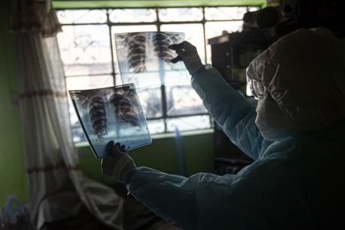 Thông tin khoa học về biến thể 'kháng vaccine' Lambda