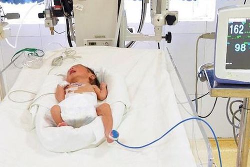 Cứu bé trai sinh non bị suy hô hấp nặng trong khu cách ly