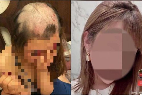 Vợ bị chồng cạo trọc đầu, nguyên nhân khiến dân mạng dậy sóng xót xa