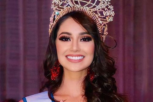 Nhan sắc tựa nữ thần của tân Hoa hậu Thế giới Colombia