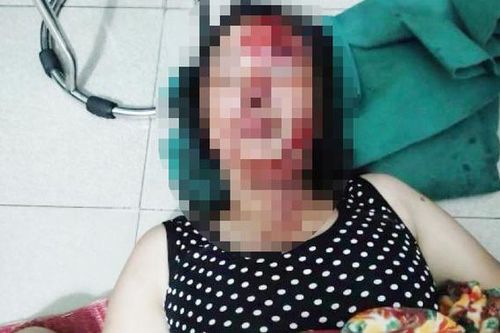 Hải Dương: Điều tra nguyên nhân chồng chích điện, dìm vợ xuống nước