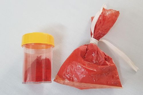 Một người ở Hà Nội nhập viện sau khi ăn phẩm màu công nghiệp trong bột nấu sốt vang