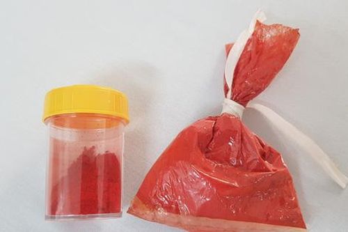 Ăn sốt vang thịt bò nấu với bột tạo màu, bệnh nhân phải nhập viện cấp cứu