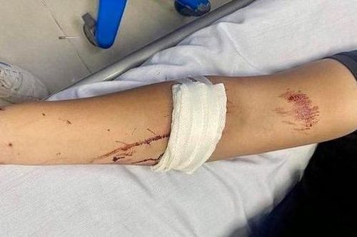 Hai nhân viên bảo vệ công trường vô cớ bị chém trọng thương