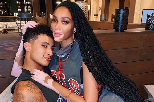 Người mẫu bạch biến Winnie Harlow chia tay bạn trai
