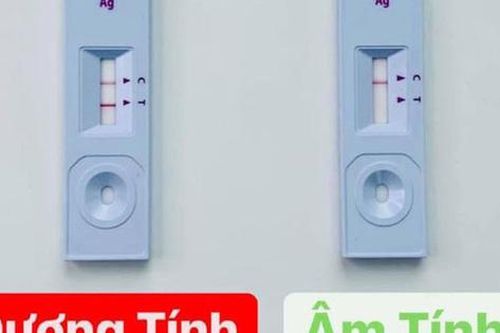 Những lưu ý khi tự test nhanh COVID-19 tại nhà