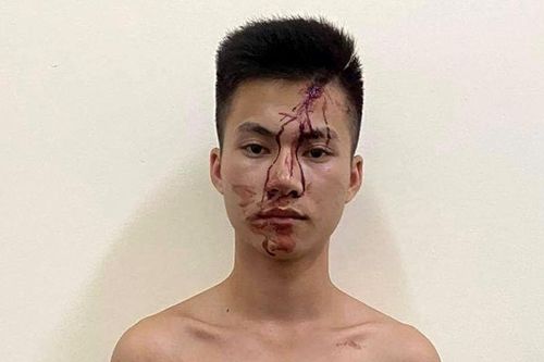 Mâu thuẫn trong lúc chơi bi-a, nam thanh niên đâm bạn tử vong tại chỗ