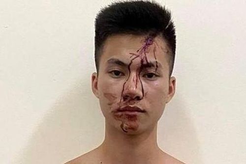 Bắt nhanh đối tượng đâm chết người từ mâu thuẫn chơi bi da