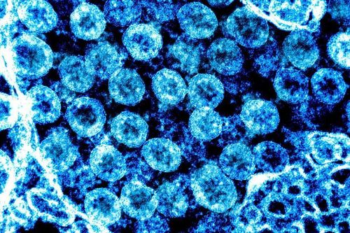 Virus SARS-CoV-2 thay đổi hình dạng để tăng khả năng sống sót