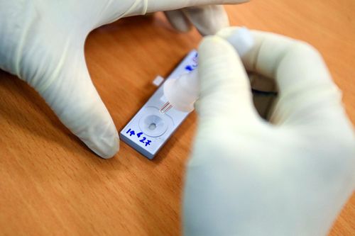 Lấy 1,4 triệu test nhanh, TP.HCM phát hiện hơn 54.000 mẫu dương tính