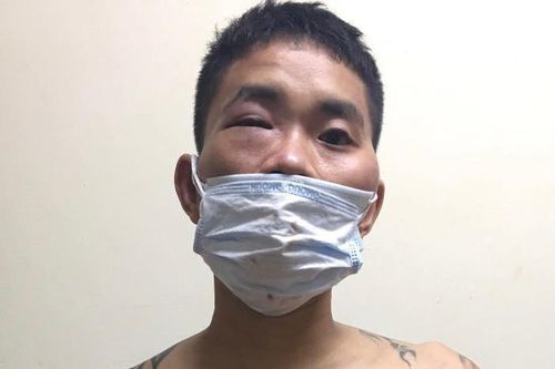 Khống chế người đàn ông làm loạn chốt kiểm dịch