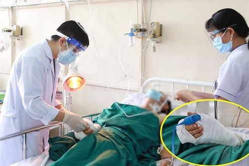 Nối thành công bàn tay người đàn ông ở Bình Dương bị chém đứt lìa