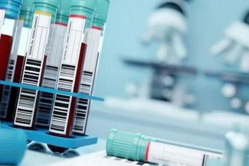 Nga cảnh báo một virus nguy hiểm lây lan mùa Thu tới