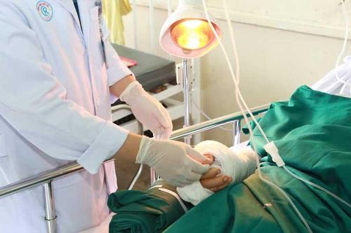 Kích hoạt báo động đỏ, ghép nối thành công bàn tay nạn nhân bị chém đứt rời