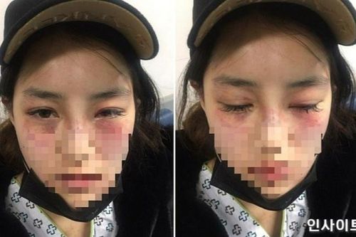 Bi kịch của những cô gái Hàn yêu đàn ông vũ phu
