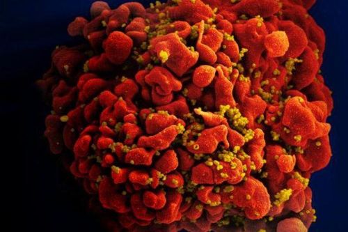 Thử nghiệm vaccine HIV tại Nam Phi thất bại