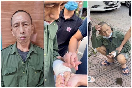Người đàn ông nghiện giả bó bột tay để giấu ma túy mang đi bán