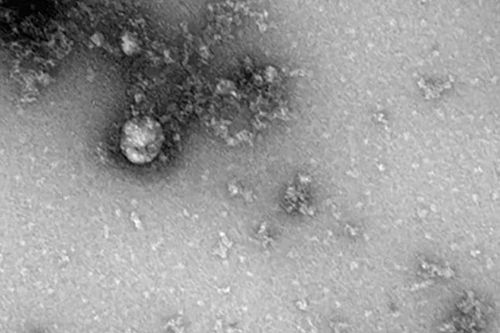 Virus corona đầu tiên xuất hiện cách đây 21.000 năm