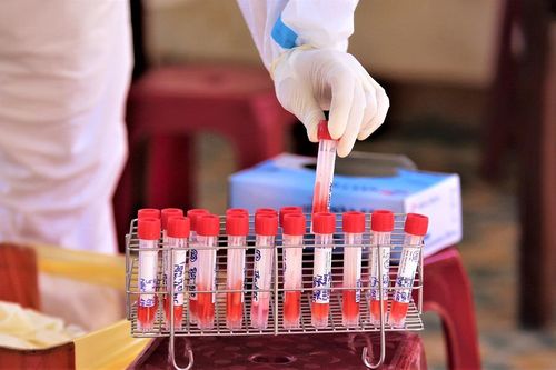 Quảng Nam: Hai bệnh nhân tâm thần mắc COVID-19 chưa rõ nguồn lây