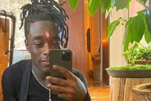 Trải nghiệm nhớ đời của rapper Mỹ gắn kim cương giá 24 triệu USD trên... trán