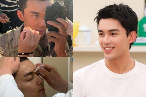 Ngô Lỗi gặp nạn bị thương khắp mặt trên phim trường, hành động sau đó khiến nhiều người nể phục