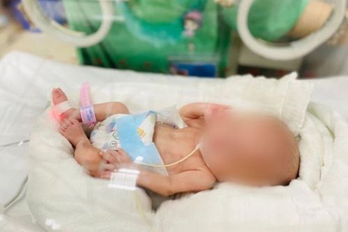 Sự sống kỳ diệu của bé sinh non nhẹ cân nhất Việt Nam, chỉ nặng 0,4kg