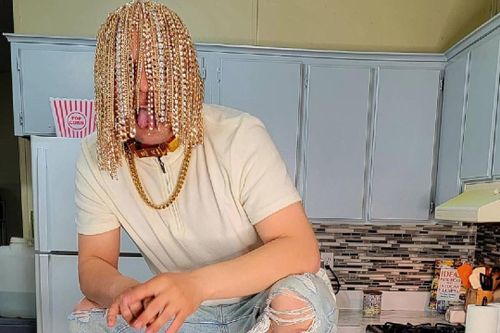 Nam rapper cấy dây chuyền vàng vào da đầu