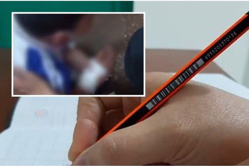 Học sinh tiểu học viết chữ xấu bị cô giáo rạch tay gây chấn động Trung Quốc