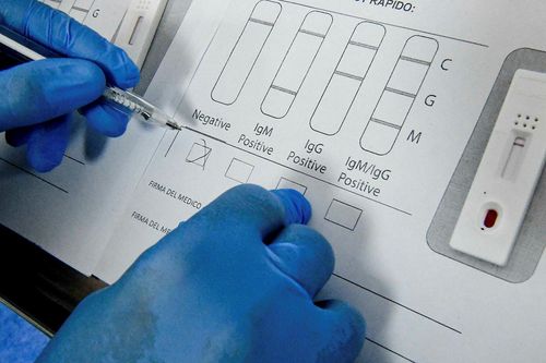 Lý do không nên test kháng thể cho người tiêm vaccine Covid-19