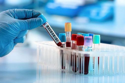 Anh thử nghiệm phương pháp xét nghiệm máu phát hiện sớm 50 loại ung thư